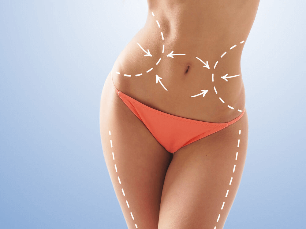 Know the Benefits of Vaser Liposuction – Premiere Surgical Arts